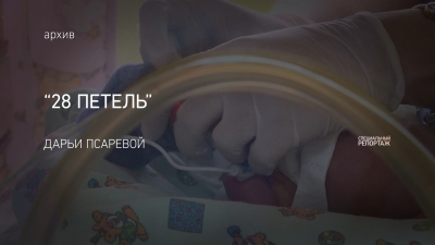 28 петель
